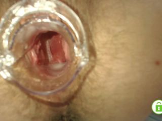 PregnantMiodelka Painful gyno exam Gaping hairy pussy wi - Doctor-7