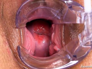 adult video clip 34 suppository fetish femdom porn | medical-fet.1213 | medical-7