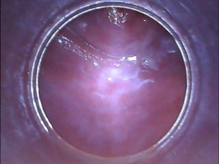 RAW endoscopic video-7