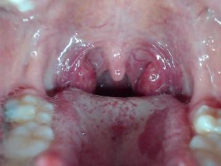 M@nyV1ds - mia_isabella3 - Braces, mouth, uvula fetish-4