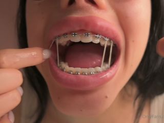 free adult clip 33 younger amateur anal anal porn | Ruth Lee - Braces Spit Fetish - [Onlyfans] (FullHD 1080p) | videos-8