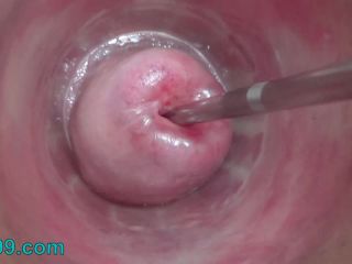 online video 21 Stim99 – Open Cervix with Speculum and Semen Insertion in Uterus, femdom empire strapon on fetish porn -3