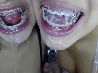 M@nyV1ds - mia_isabella3 - Extreme blowjob with braces-8