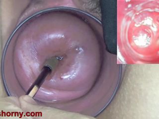 Cervix Endoscope Camera Insertion To Watch Inside Uterus in "Cervix Endoscope Camera Insertion To Watch Inside Uterus"  | speculum | webcam chastity fetish-5